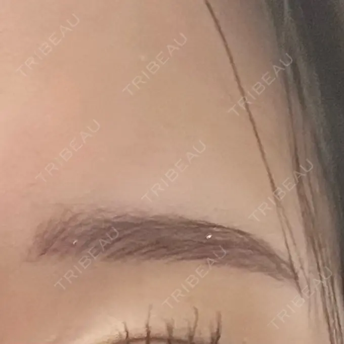 アートメイク（眉） 平和台皮フ科 DAY 1 メイン用