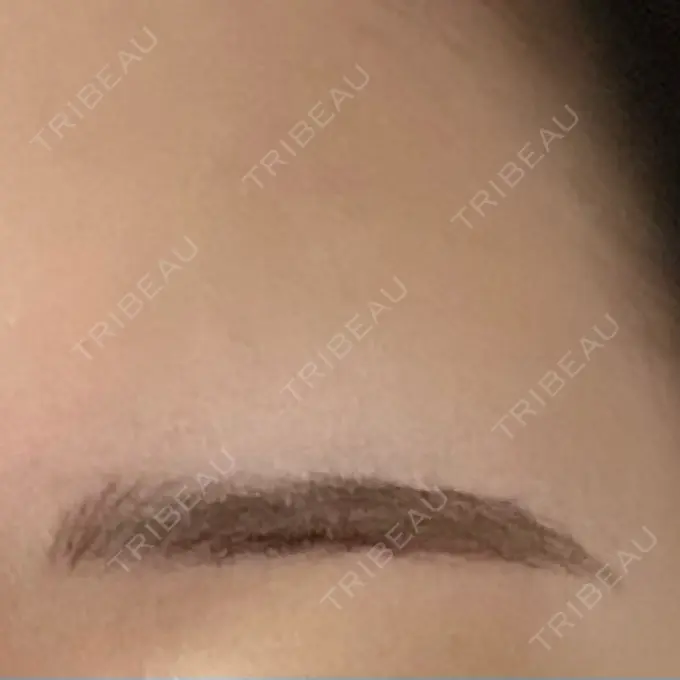 アートメイク（眉） 平和台皮フ科 DAY 2 メイン用