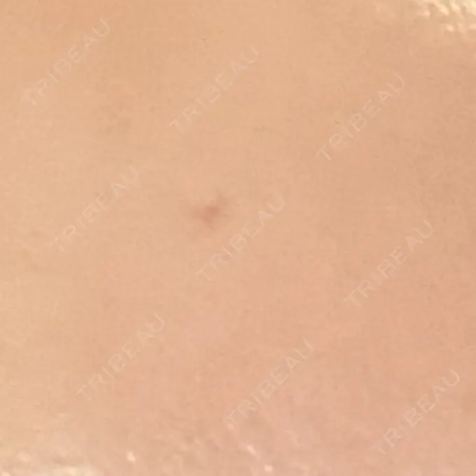 プラセンタ注射 吉祥寺アイビークリニック DAY 3 メイン用