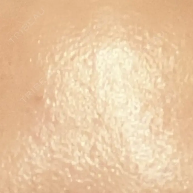 プラセンタ注射 吉祥寺アイビークリニック DAY 5 メイン用