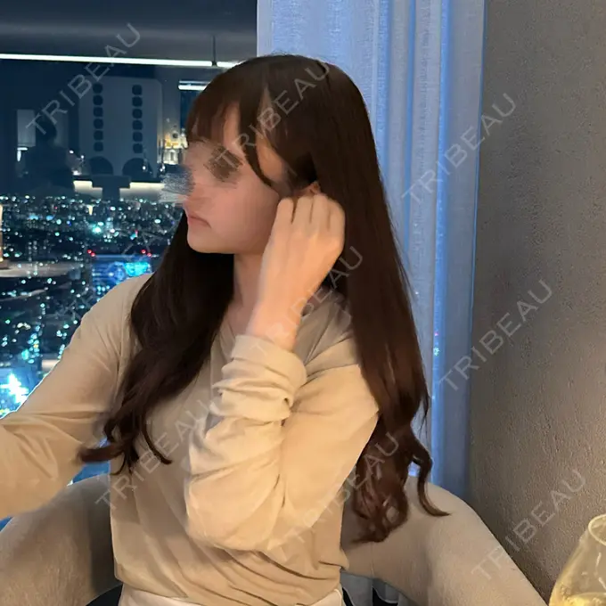 糸リフト / 脂肪吸引（顔） / ボトックス（エラ・小顔） / 脂肪注入（輪郭） First Clinic DAY 14 メイン用