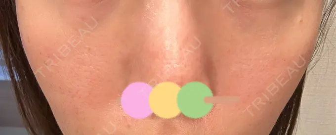 その他（肌） シンデレラ＆ダヴィンチクリニック DAY 1 メイン用