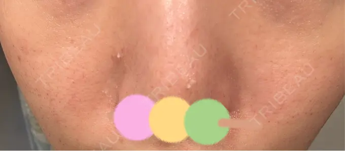 その他（肌） シンデレラ＆ダヴィンチクリニック DAY 2 メイン用