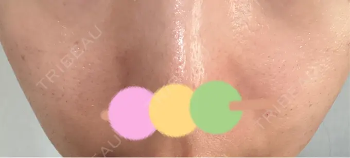 その他（肌） シンデレラ＆ダヴィンチクリニック DAY 3 メイン用