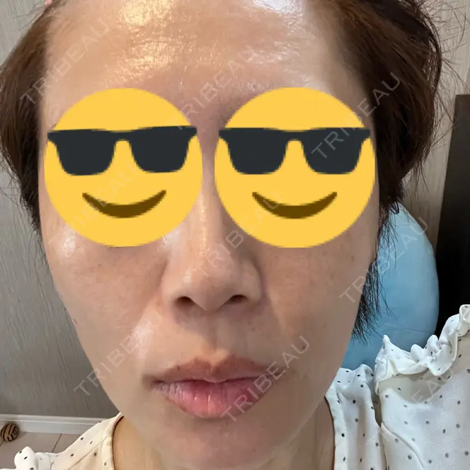 ルメッカ 東京美容外科 池袋院 AFTER メイン用