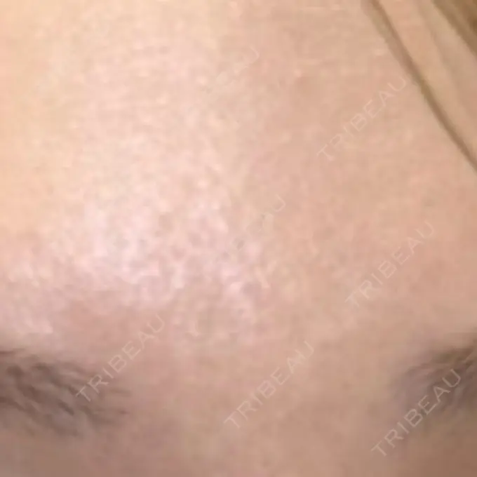 美容点滴・美容注射（美肌） 城本クリニック 名古屋院 AFTER メイン用