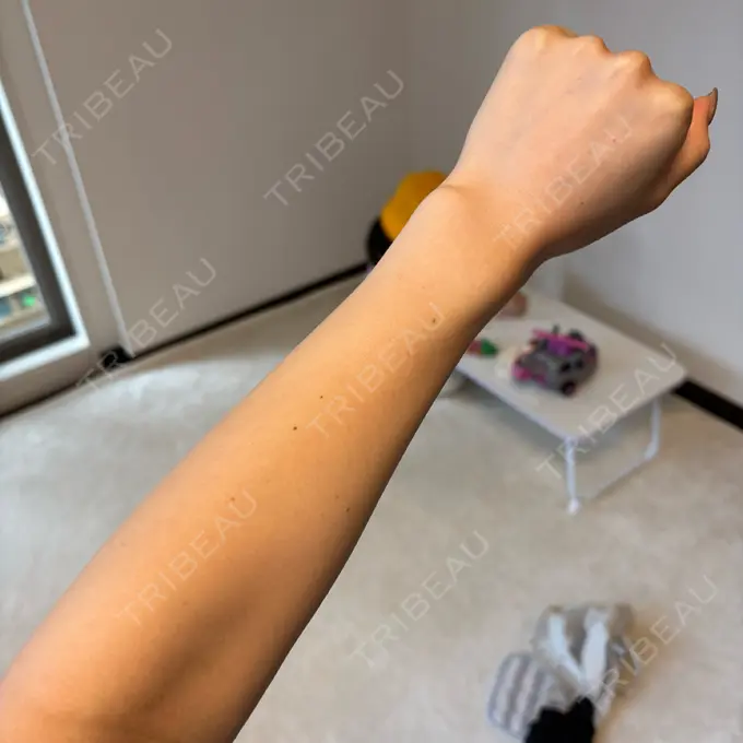 美容点滴・美容注射（美肌） 城本クリニック 名古屋院 AFTER メイン用