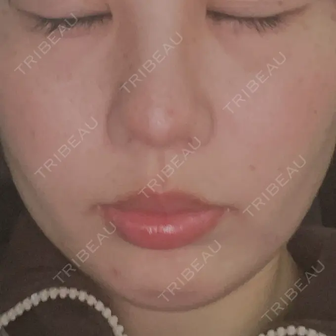 ルメッカ Grias clinic （ジリアスクリニック） DAY 4 メイン用