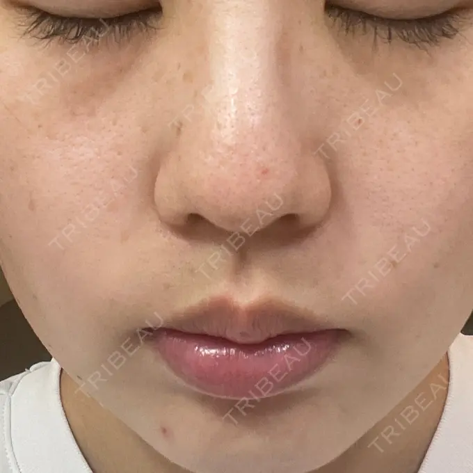 ルメッカ Grias clinic （ジリアスクリニック） DAY 5 メイン用