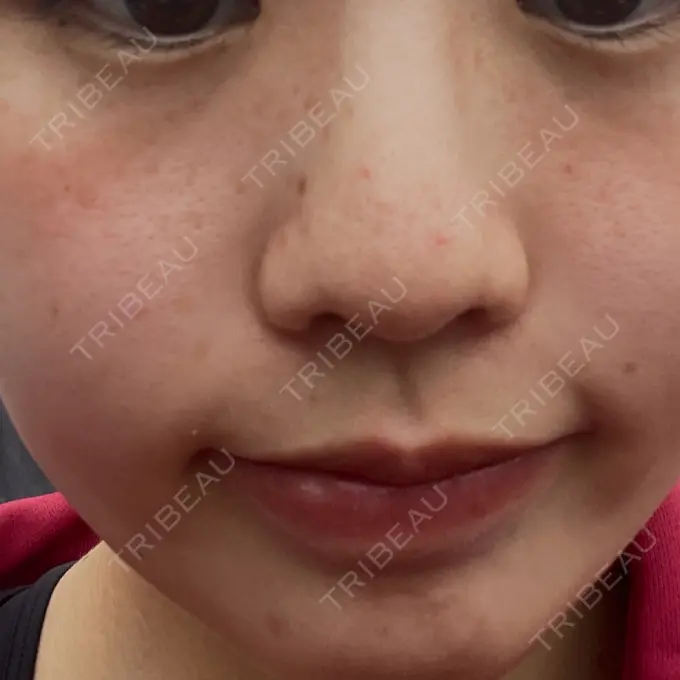 ルメッカ Grias clinic （ジリアスクリニック） DAY 9 メイン用