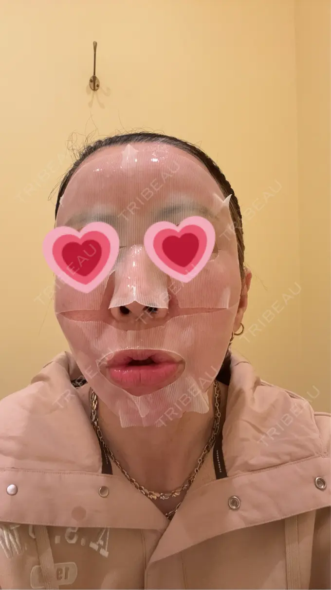 ポテンツァ ルラ美容クリニック 大宮院 / ルラスキンクリニック 大宮院 DAY 0 メイン用