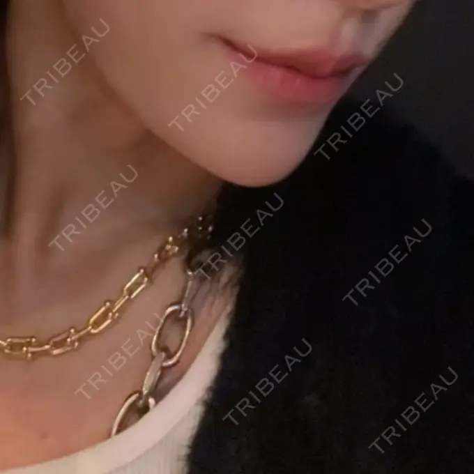 ハイフ（顔） クレオビューティークリニック AFTER メイン用