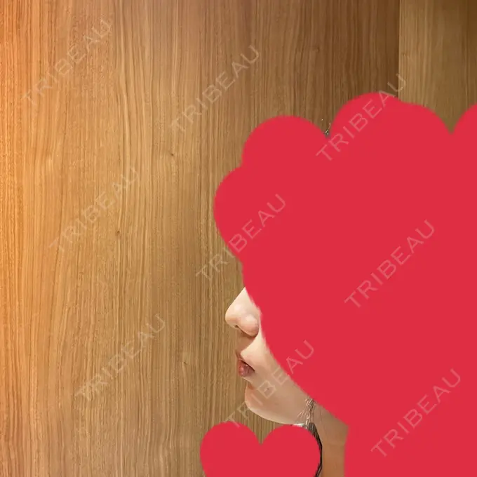 ボトックス（あご） / ヒアルロン酸注入（あご） HAAB×DREAM BEAUTY CLINIC 大阪梅田院 DAY 6 メイン用