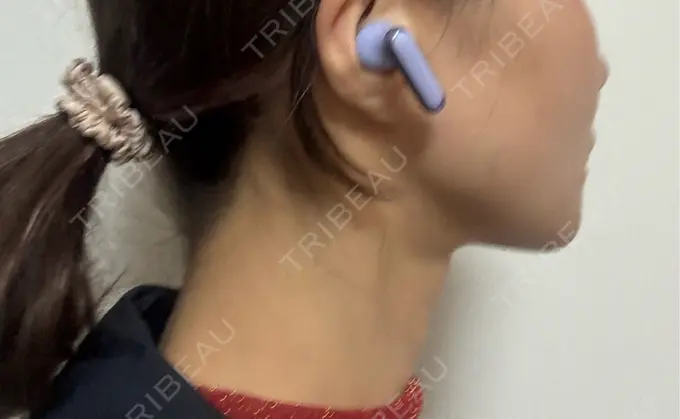 ボトックス（エラ・小顔） / ボトックス（肩） / ボトックス（眉間） / ボトックス（目尻） / ボトックス（額） / ボトックス（首） / ボトックス（人中） / ボトックス（バニーライン） DMTC CLINIC 日本橋院 DAY 2 メイン用