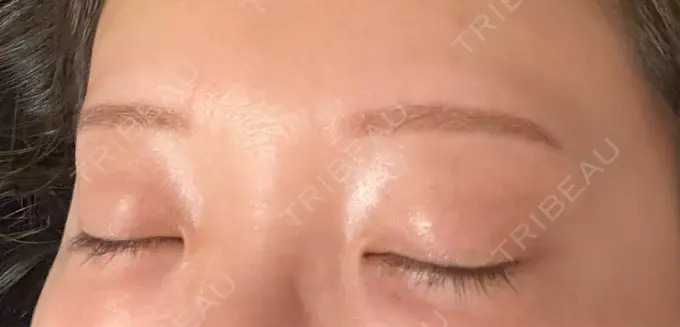 アートメイク（眉） design beauty clinic 梅田本院 DAY 6 メイン用