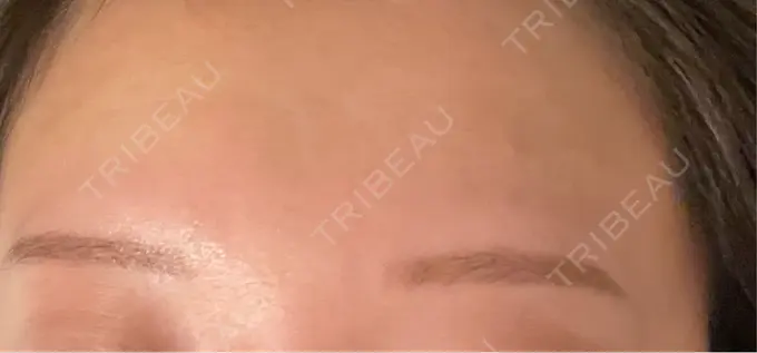 アートメイク（眉） design beauty clinic 梅田本院 DAY 8 メイン用