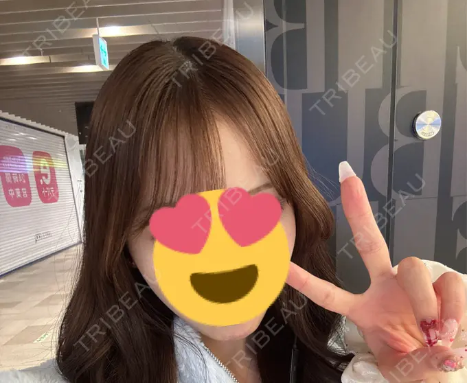 ヒアルロン酸溶解 EOL CLINIC【オルクリニック】 AFTER メイン用