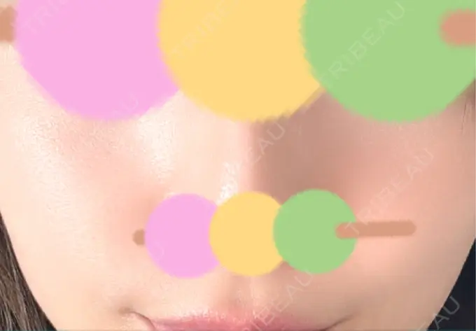 その他（肌） シンデレラ＆ダヴィンチクリニック AFTER メイン用