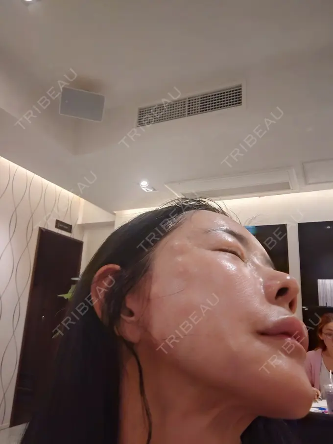 ジャルプロ Natural Skin Clinic 自由ヶ丘院 AFTER メイン用