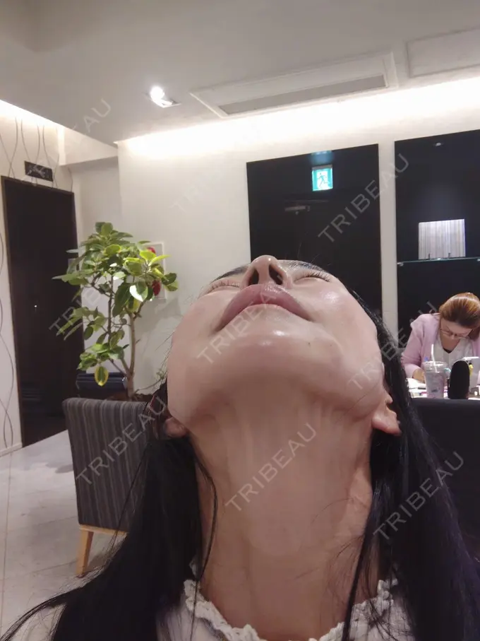 ジャルプロ Natural Skin Clinic 自由ヶ丘院 DAY 0 メイン用