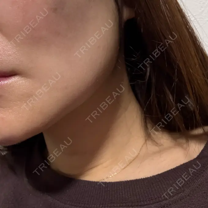 ジャルプロ エクラクリニック 大宮 DAY 0 メイン用