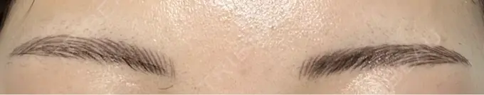 アートメイク（眉） 平和台皮フ科 DAY 3 メイン用
