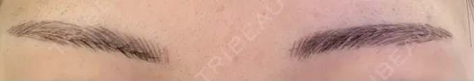 アートメイク（眉） 平和台皮フ科 DAY 4 メイン用