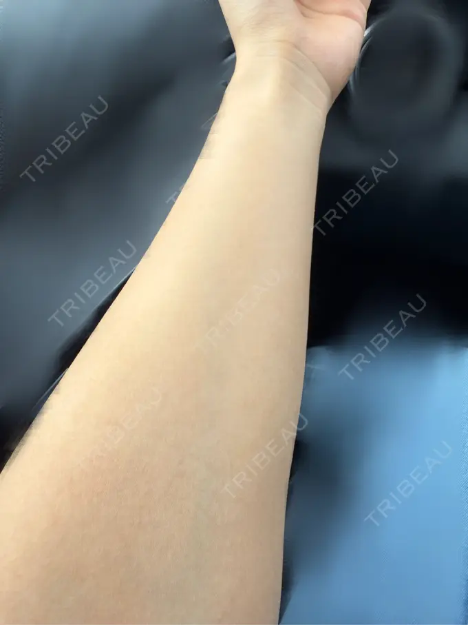 美容点滴・美容注射（美肌） / 白玉点滴・注射 城本クリニック 姫路院 AFTER メイン用