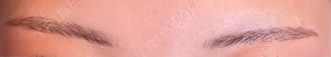 アートメイク（眉） 平和台皮フ科 DAY 8 メイン用