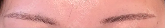 アートメイク（眉） 平和台皮フ科 DAY 10 メイン用