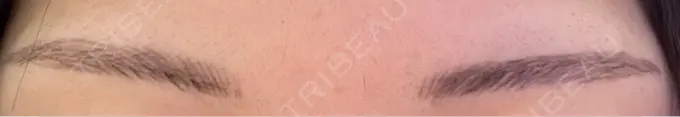 アートメイク（眉） 平和台皮フ科 AFTER メイン用