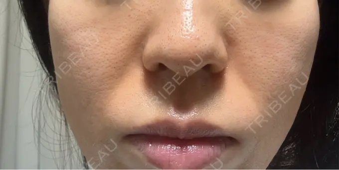 ジャルプロ 城本クリニック 静岡院 DAY 6 メイン用