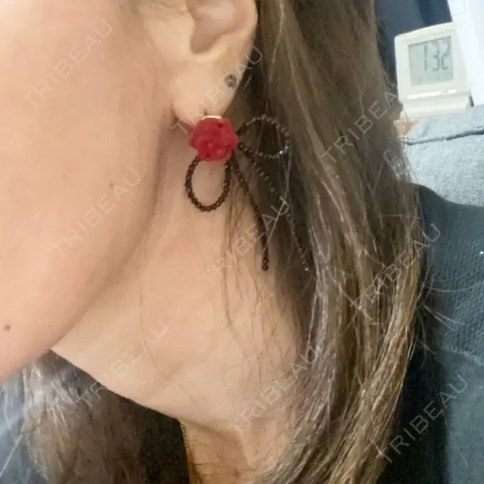 肌ヒアルロン酸注入（たるみ・シワ改善） 城本クリニック 新宿院 DAY 2 メイン用