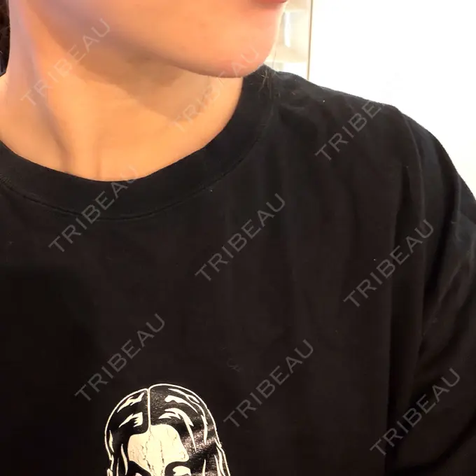 ボトックス（あご） / ヒアルロン酸注入（あご） TCB東京中央美容外科 越谷院 AFTER メイン用