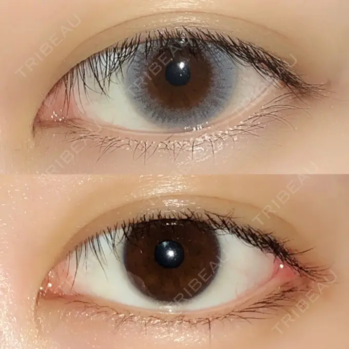 目頭切開 / 目尻切開 エートップ美容整形外科 DAY 61 メイン用