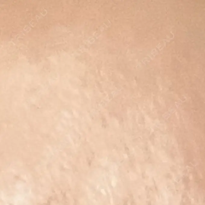 プラセンタ注射 新宿駅三丁目クリニック DAY 5 メイン用