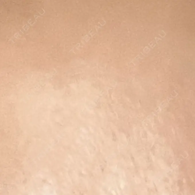 プラセンタ注射 吉祥寺アイビークリニック DAY 4 メイン用