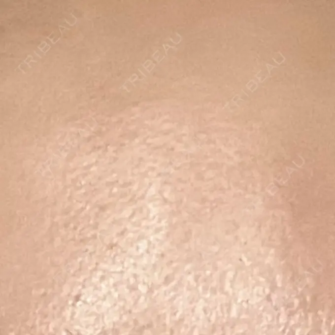 プラセンタ注射 吉祥寺アイビークリニック DAY 6 メイン用