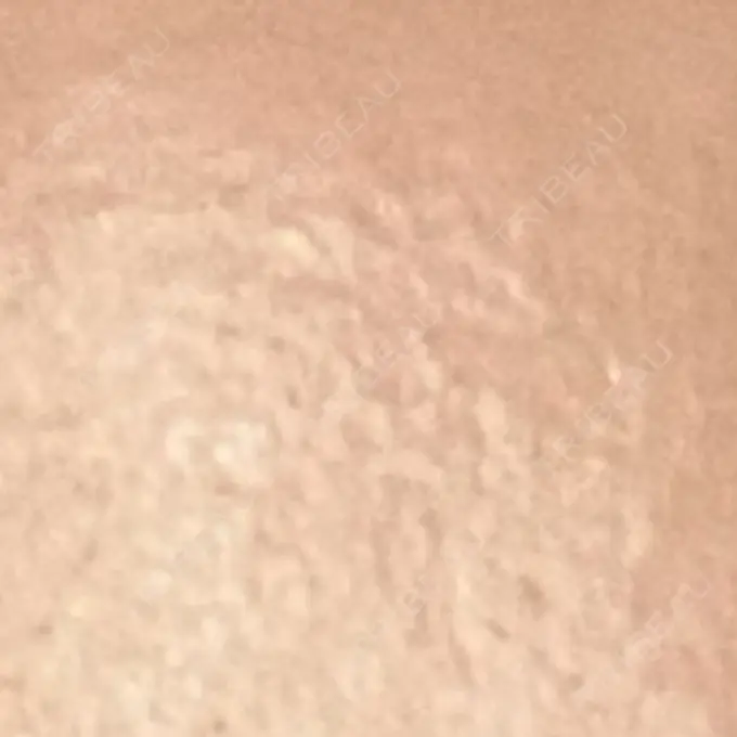 プラセンタ注射 吉祥寺アイビークリニック DAY 7 メイン用