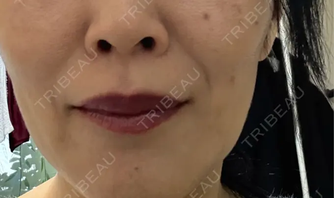 アートメイク（眉） LEAGRANT CLINIC 中目黒 AFTER メイン用