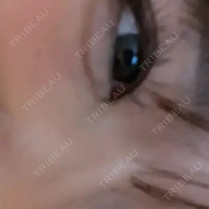 ヒアルロン酸注入（涙袋） 麻布十番クレールデンタルクリニック AFTER メイン用