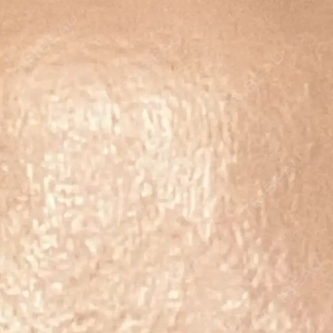 プラセンタ注射 吉祥寺アイビークリニック DAY 9 メイン用