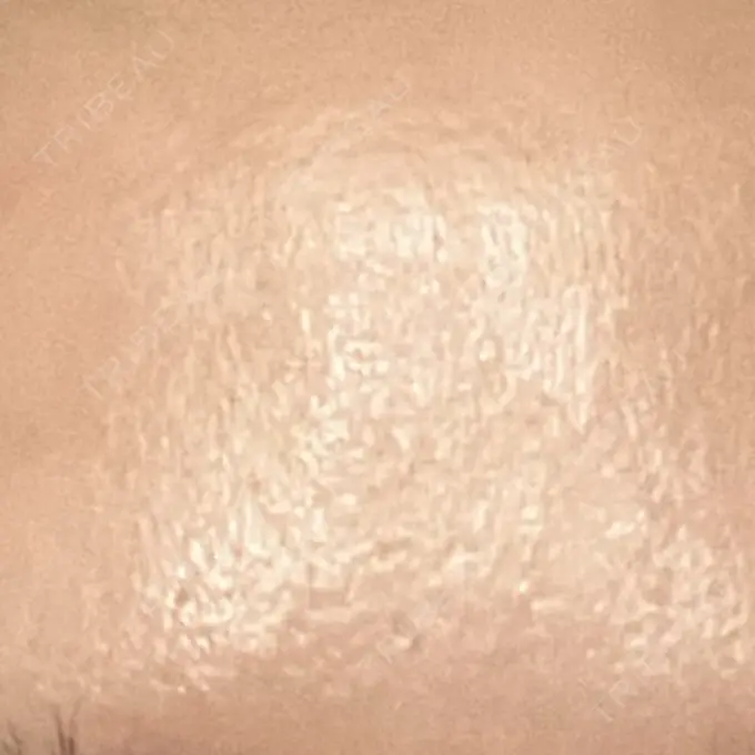 プラセンタ注射 新宿駅三丁目クリニック DAY 4 メイン用