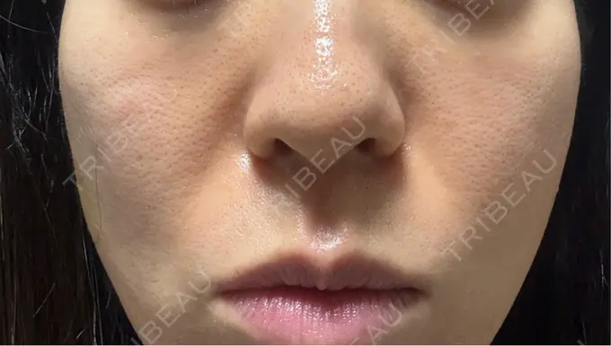 ジャルプロ 城本クリニック 静岡院 DAY 8 メイン用