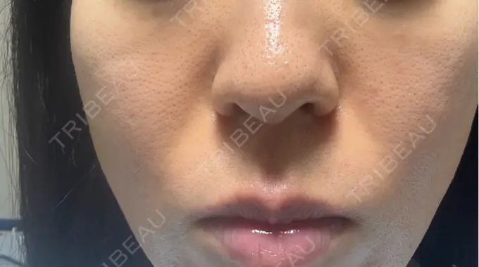 ジャルプロ 城本クリニック 静岡院 DAY 9 メイン用