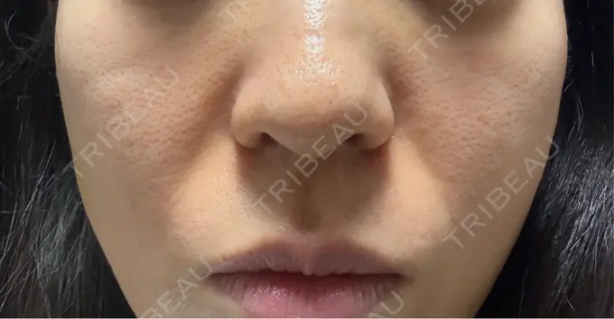 ジャルプロ 城本クリニック 静岡院 DAY 12 メイン用