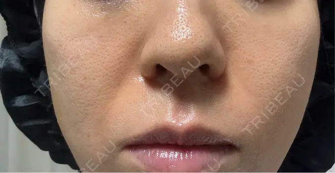 ジャルプロ 城本クリニック 静岡院 DAY 15 メイン用