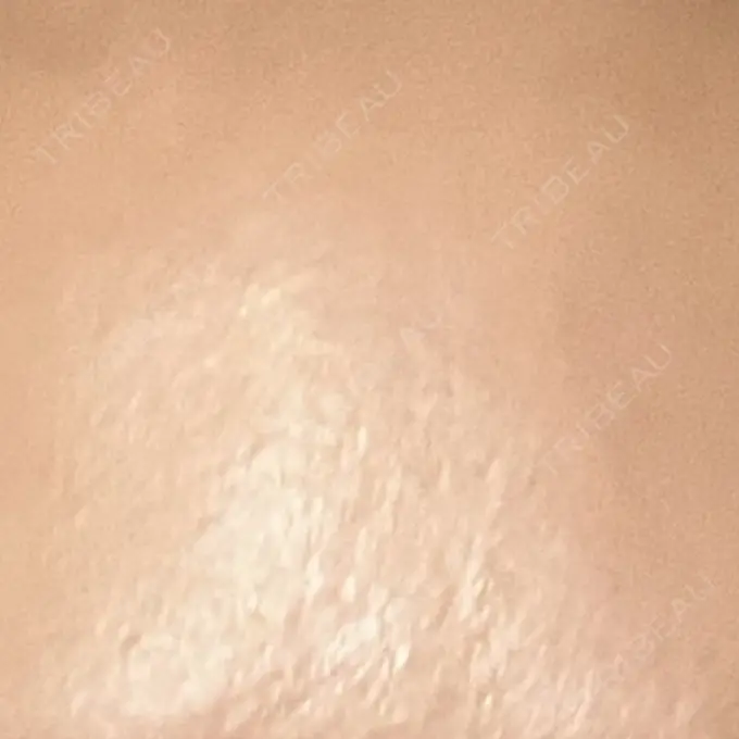 プラセンタ注射 吉祥寺アイビークリニック DAY 4 メイン用