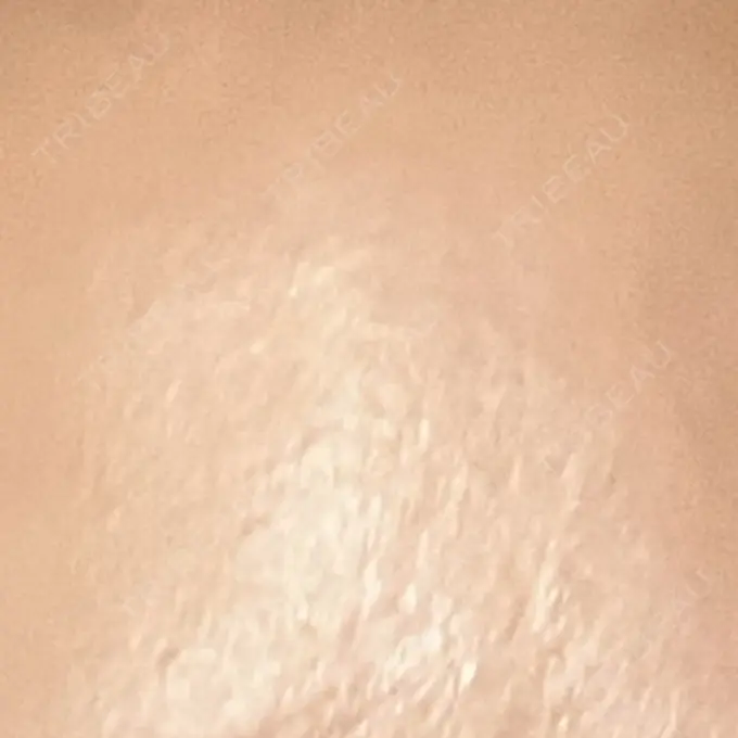 プラセンタ注射 新宿駅三丁目クリニック DAY 1 メイン用