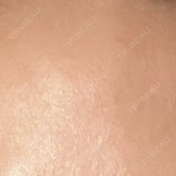 プラセンタ注射 新宿駅三丁目クリニック AFTER メイン用